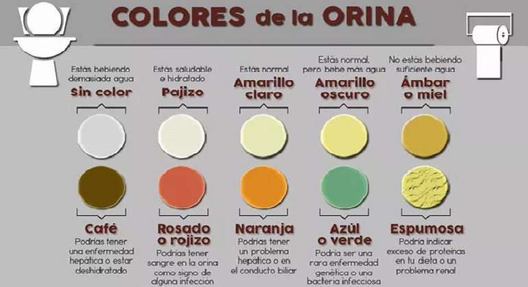 color orina