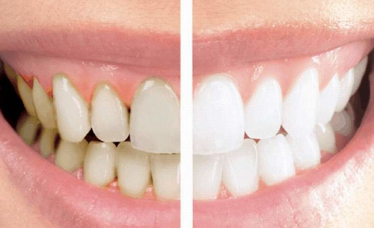 dientes